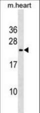 Mouse Trem2 Antibody western blot of mouse heart tissue lysates (35 ug/lane). The Trem2 antibody detected the Trem2 protein (arrow).