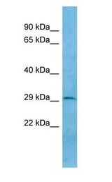 TREML1 / TLT1 antibody Western Blot of Human Placenta.