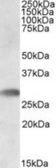 TREML1 antibody staining (0.5 ug/ml) of Human Bone Marrow lysate (RIPA buffer, 35g total protein per lane). Primary incubated for 1 hour. Detected by Western blot of chemiluminescence.