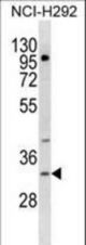 TREML1 Antibody western blot of NCI-H292 cell line lysates (35 ug/lane). The TREML1 antibody detected the TREML1 protein (arrow).