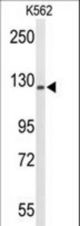 Western blot of TREF1 Antibody in K562 cell line lysates (35 ug/lane). TREF1 (arrow) was detected using the purified antibody.