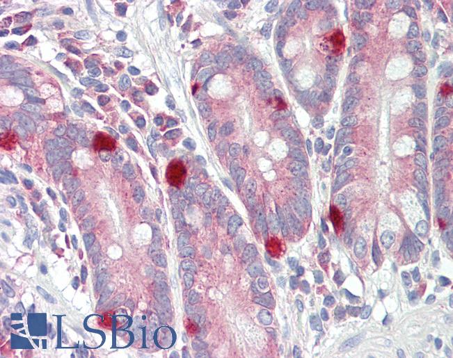 Anti-TRERF1 antibody IHC of human small intestine. Immunohistochemistry of formalin-fixed, paraffin-embedded tissue after heat-induced antigen retrieval. Antibody LS-B8430 dilution 5 ug/ml.