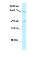 TRERF1 antibody LS-C145688 Western blot of 721_B Cell lysate. Antibody concentration 1 ug/ml.