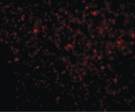 Immunofluorescence of TREX1 in Human Spleen cells with TREX1 antibody at 20 ug/ml.