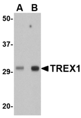 Western blot of TREX1 in human spleen tissue lysate with TREX1 antibody at (A) 0.5 ug/ml and (B) 1 ug/ml