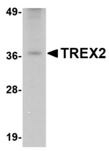Western blot of TREX2 in rat liver tissue lysate with TREX2 antibody at 2.5 ug/ml
