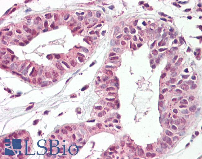 Anti-TREX2 antibody IHC of human breast. Immunohistochemistry of formalin-fixed, paraffin-embedded tissue after heat-induced antigen retrieval. Antibody LS-B7359 concentration 3.75 ug/ml.