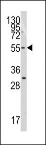 Western blot of anti-TERF1 antibody in Jurkat cell line lysates (35 ug/lane). TERF1(arrow) was detected using the purified antibody.