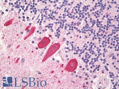 Anti-TRH antibody IHC staining of human brain, cerebellum, purkinje. Immunohistochemistry of formalin-fixed, paraffin-embedded tissue after heat-induced antigen retrieval.
