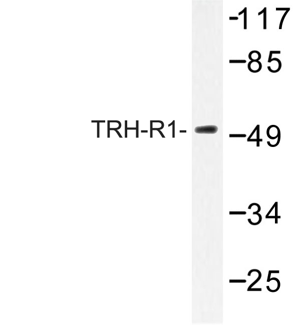 Western blot of TRH-R1 (W234) pAb in extracts from COS7 cells.