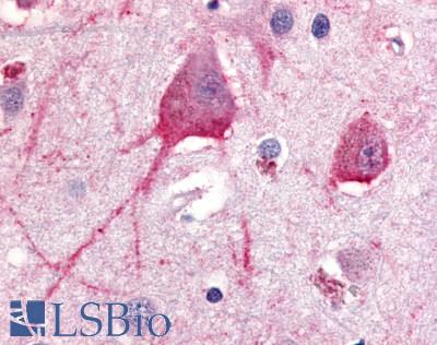 Anti-TRH Receptor antibody LS-A1198 IHC of human brain, neurons and glia. Immunohistochemistry of formalin-fixed, paraffin-embedded tissue after heat-induced antigen retrieval.