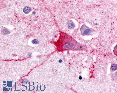 Anti-TRH Receptor antibody LS-A1196 IHC of human brain, neurons and glia. Immunohistochemistry of formalin-fixed, paraffin-embedded tissue after heat-induced antigen retrieval.