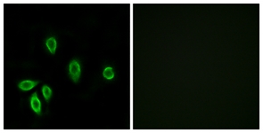 Immunofluorescence of A549 cells, using TRHR Antibody. The picture on the right is treated with the synthesized peptide.