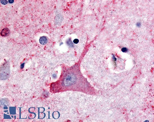 Anti-TRH Receptor antibody LS-A1199 IHC of human brain, neuron. Immunohistochemistry of formalin-fixed, paraffin-embedded tissue after heat-induced antigen retrieval.