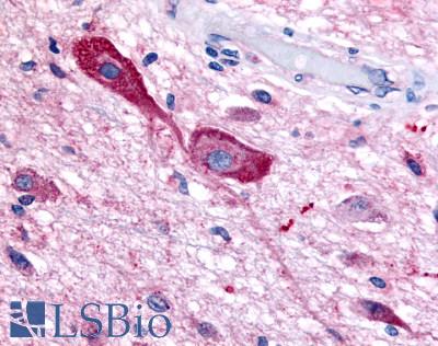 Anti-TRH Receptor antibody LS-A1200 IHC of human brain, neurons and glia. Immunohistochemistry of formalin-fixed, paraffin-embedded tissue after heat-induced antigen retrieval.