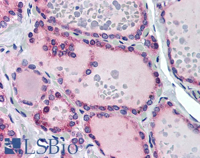 Anti-TRH Receptor antibody IHC of human thyroid. Immunohistochemistry of formalin-fixed, paraffin-embedded tissue after heat-induced antigen retrieval. Antibody LS-B1788 concentration 10 ug/ml.