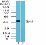 Western blot of human TRH-R in human brain lysate in the 1) absence and 2) presence of immunizing peptide using antibody at 0.5 ug/ml.