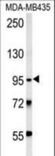 TRHDE Antibody western blot of MDA-MB435 cell line lysates (15 ug/lane). The TRHDE antibody detected the TRHDE protein (arrow).