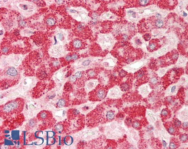 Human Liver: Formalin-Fixed, Paraffin-Embedded (FFPE)