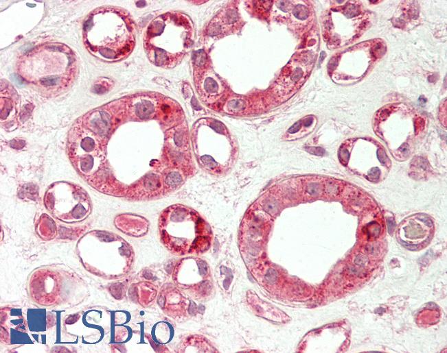 Human Kidney: Formalin-Fixed, Paraffin-Embedded (FFPE)