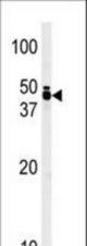 Western blot of anti-TRIB1 antibody in T47D cell line lysate (35 ug/lane). TRIB1(arrow) was detected using the purified antibody.