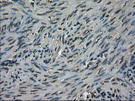IHC of paraffin-embedded endometrium tissue using anti-TRIB2 mouse monoclonal antibody. (Dilution 1:50).
