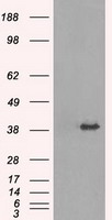 HEK293T cells were transfected with the pCMV6-ENTRY control (Left lane) or pCMV6-ENTRY TRIB2 (Right lane) cDNA for 48 hrs and lysed. Equivalent amounts of cell lysates (5 ug per lane) were separated by SDS-PAGE and immunoblotted with anti-TRIB2.