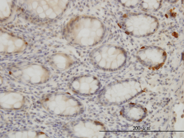 Immunoperoxidase of monoclonal antibody to TRIB2 on formalin-fixed paraffin-embedded human colon. [antibody concentration 3 ug/ml]
