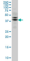 TRIB2 monoclonal antibody (M04), clone 1B1 Western blot of TRIB2 expression in Jurkat.