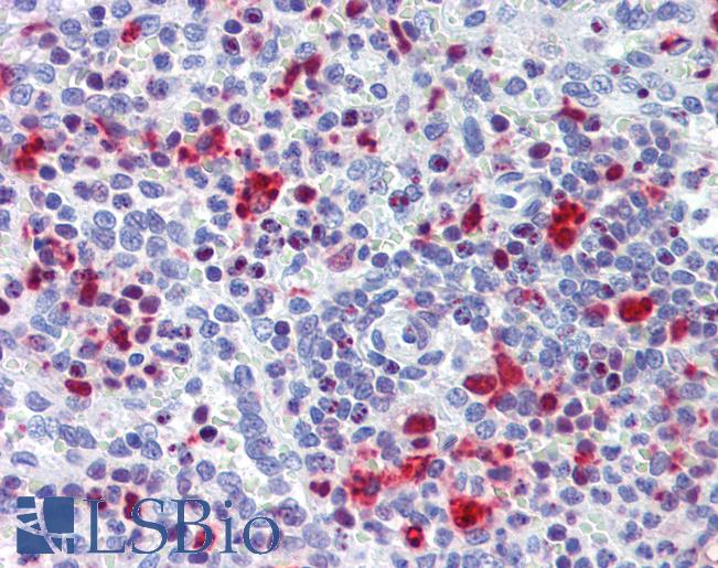 Anti-TRIB2 antibody IHC of human spleen. Immunohistochemistry of formalin-fixed, paraffin-embedded tissue after heat-induced antigen retrieval. Antibody LS-B3826 concentration 3.75 ug/ml.