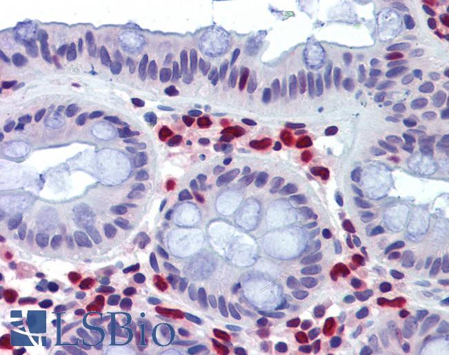 Anti-TRIB2 antibody IHC of human colon. Immunohistochemistry of formalin-fixed, paraffin-embedded tissue after heat-induced antigen retrieval. Antibody LS-B3826 concentration 3.75 ug/ml.