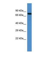 Western blot of Human NCI-H226. MID2 antibody dilution 1.0 ug/ml.