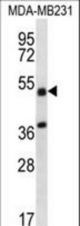 TRIM10 Antibody western blot of MDA-MB231 cell line lysates (35 ug/lane). The TRIM10 antibody detected the TRIM10 protein (arrow).