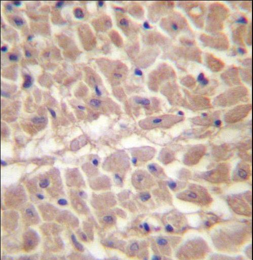 TRIM11 Antibody immunohistochemistry of formalin-fixed and paraffin-embedded human heart tissue followed by peroxidase-conjugated secondary antibody and DAB staining.