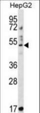 TRIM11 Antibody western blot of HepG2 cell line lysates (35 ug/lane). The TRIM11 antibody detected the TRIM11 protein (arrow).