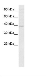 Jurkat Cell Lysate