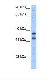 Transfected 293T cell lysate. Antibody concentration: 2.5 ug/ml. Gel concentration: 12%.