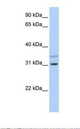721_B cell lysate. Antibody concentration: 1.0 ug/ml. Gel concentration: 12%.