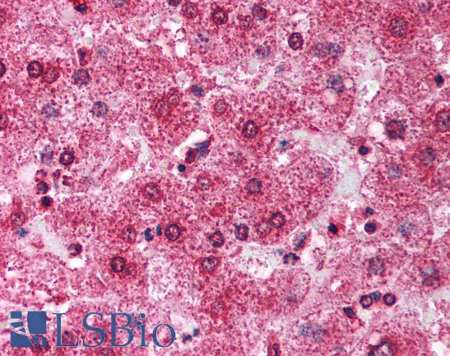 Anti-TRIM14 antibody IHC of human liver. Immunohistochemistry of formalin-fixed, paraffin-embedded tissue after heat-induced antigen retrieval. Antibody LS-B1102 concentration 5 ug/ml.