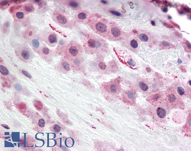Anti-TLR4 antibody LS-A9705 IHC of human placenta, decidua. Immunohistochemistry of formalin-fixed, paraffin-embedded tissue after heat-induced antigen retrieval.