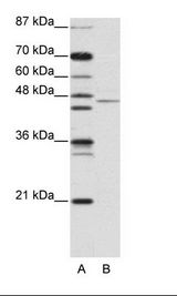 A: Marker, B: Jurkat Cell Lysate