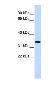 TRIM14 antibody LS-C101521 Western blot of Fetal liver lysate.