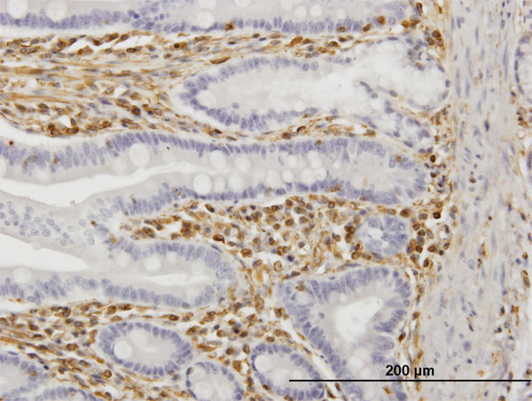 Immunoperoxidase of monoclonal antibody to TRIM16 on formalin-fixed paraffin-embedded human small Intestine. [antibody concentration 3 ug/ml]