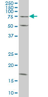 TRIM16 monoclonal antibody (M02), clone 5G11 Western blot of TRIM16 expression in Jurkat.