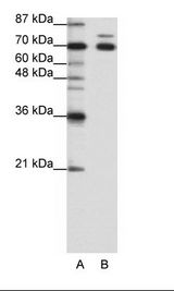 A: Marker, B: HepG2 Cell Lysate