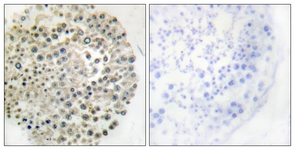 IHC of paraffin-embedded human testis, using TRIM16 Antibody. The picture on the right is treated with the synthesized peptide.