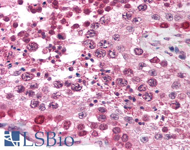 Anti-TRIM17 antibody IHC of human testis. Immunohistochemistry of formalin-fixed, paraffin-embedded tissue after heat-induced antigen retrieval. Antibody LS-B1103 concentration 5 ug/ml.