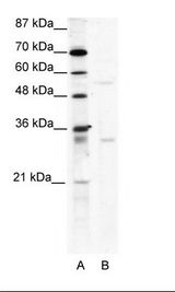 A: Marker, B: HepG2 Cell Lysate