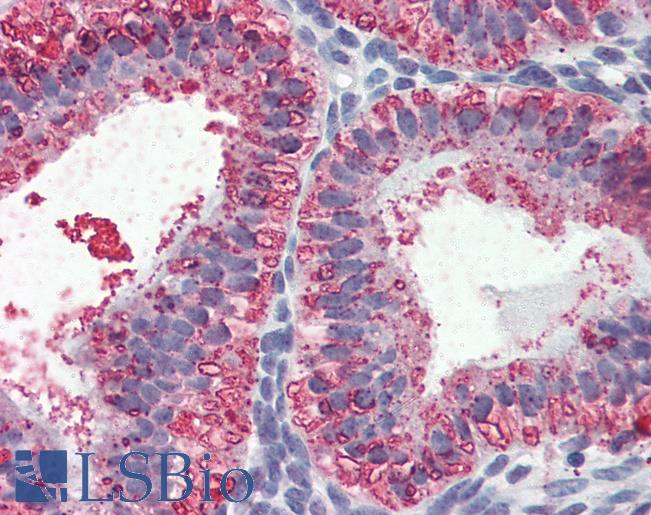 Anti-TRIM21 antibody IHC of human uterus. Immunohistochemistry of formalin-fixed, paraffin-embedded tissue after heat-induced antigen retrieval. Antibody LS-B3096 concentration 10 ug/ml.