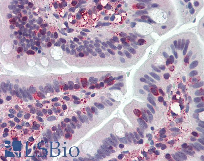 Anti-TRIM21 antibody IHC of human small intestine. Immunohistochemistry of formalin-fixed, paraffin-embedded tissue after heat-induced antigen retrieval. Antibody LS-B3096 concentration 10 ug/ml.